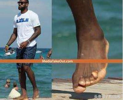 nba球员的脚三大事故 看看NBA球星的脚(4)