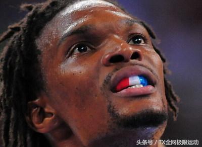 nba球员的牙打掉 NBA球员没了牙套会怎么样(2)