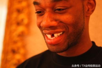 nba球员的牙打掉 NBA球员没了牙套会怎么样(4)
