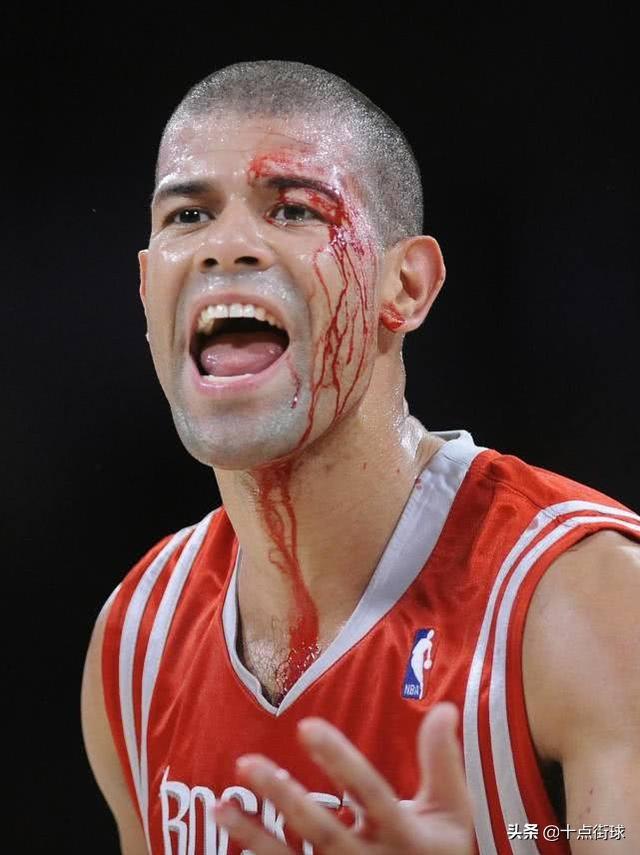 nba球员受伤后 当NBA球员受伤后(1)