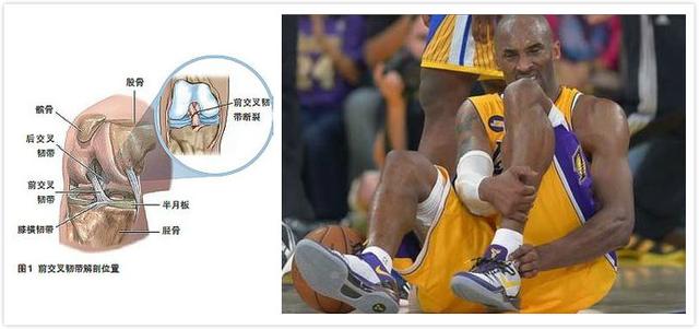 nba球星最常见的伤病 解密NBA球员常见伤病(8)