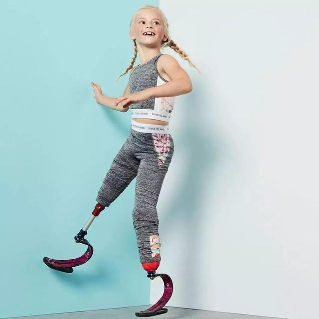 7岁被截肢的她，逆天改命，会芭蕾、田径、体操，是怎么做到的？(20)