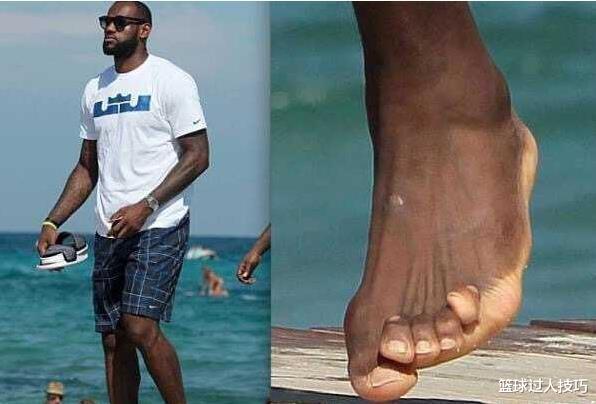 看了詹姆斯脚趾、马龙白发、罗斯膝盖，你还羡慕NBA球星高薪吗？