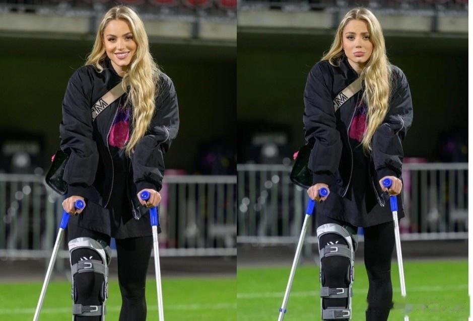 最美女足球员拄着拐杖依旧引人关注
克罗地亚球星安娜·玛丽亚·马尔科维奇在社交网络(1)