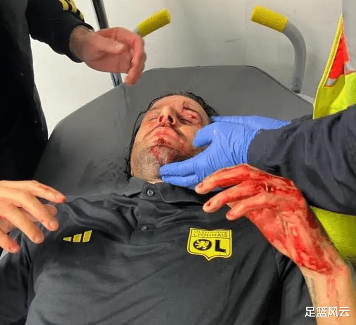 里昂主帅格罗索和助教受球迷袭击受伤，但马赛不会受任何体育制裁，对此如何评价？